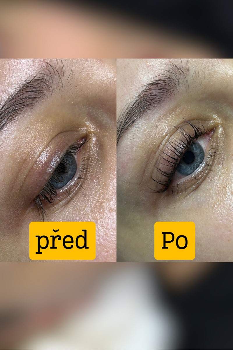  20/20